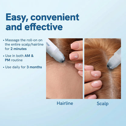 Advanced Hair Density Roll-On
