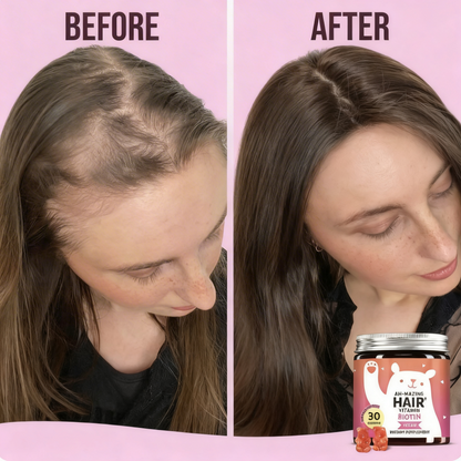 BuffBolt™ Hair Growth Gummies