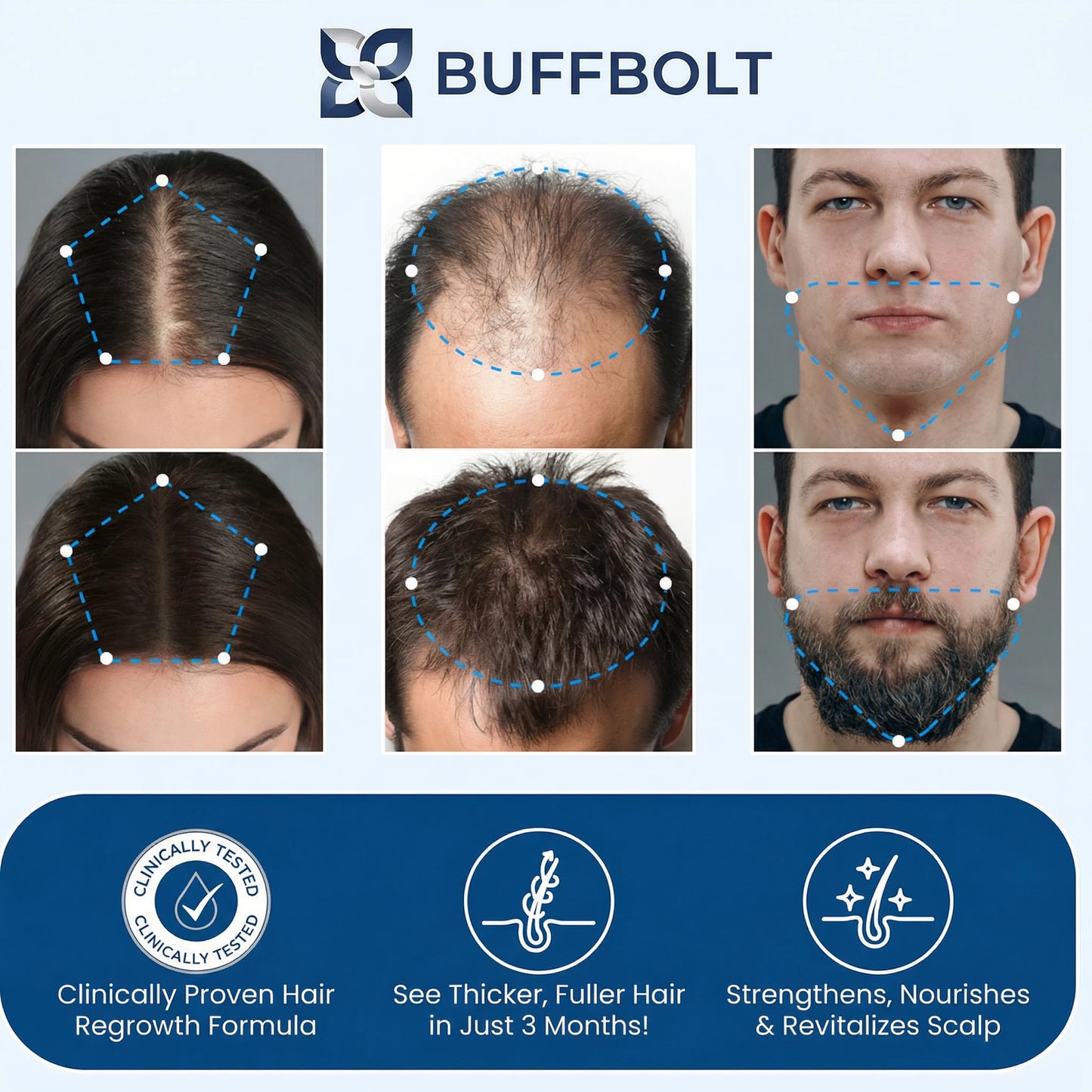 Advanced Hair Density Roll-On