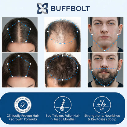 Advanced Hair Density Roll-On