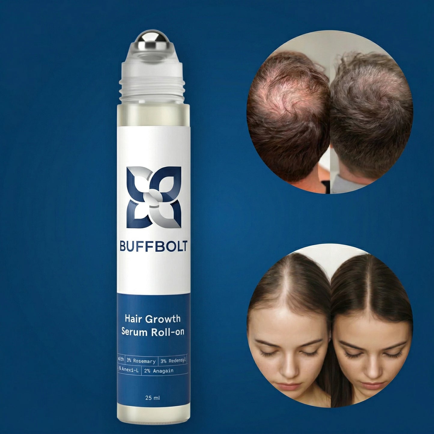 Advanced Hair Density Roll-On