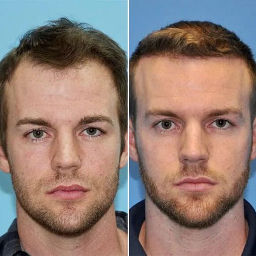 <h2>Loved by everyone, everywhere. Don't miss out.</h2>