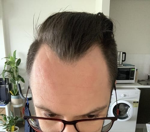 <h2>Loved by everyone, everywhere. Don't miss out.</h2>