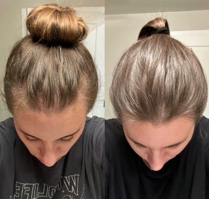 Advanced Hair Density Roll-On